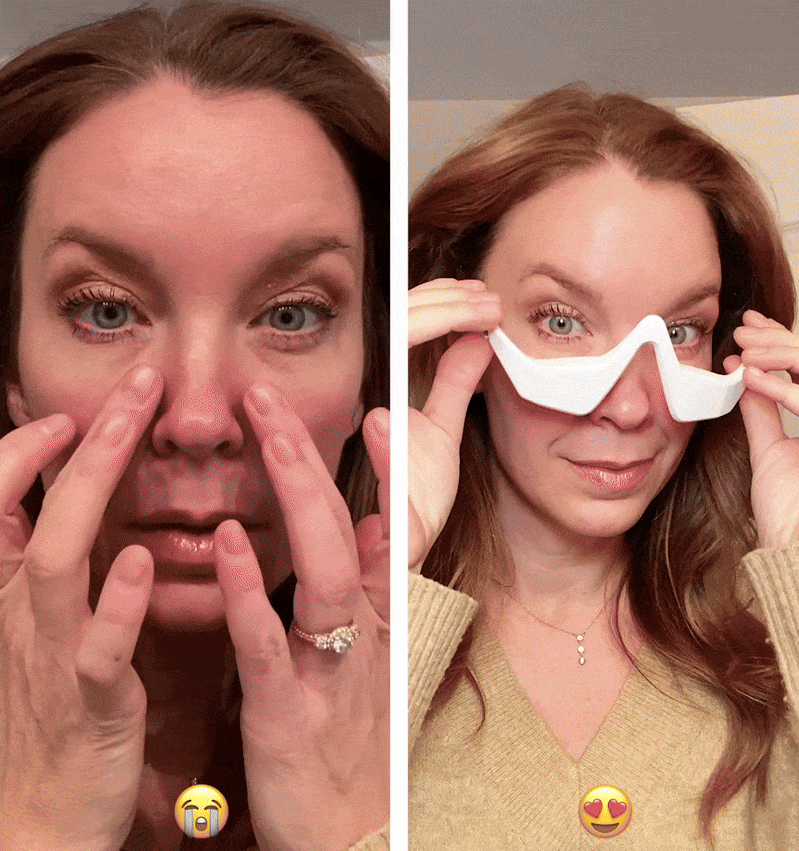 Aura RevitalEyes - Regeneración Facial Avanzada